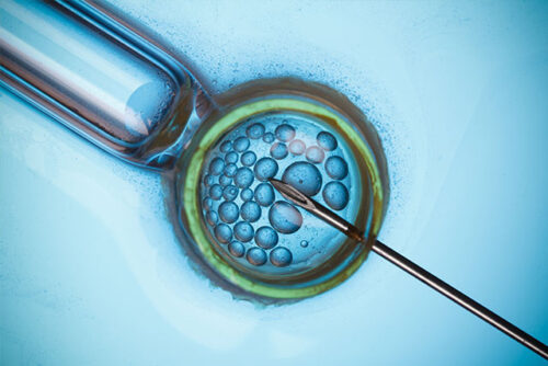 Image of a persons reproductive eggs in a microscope.
