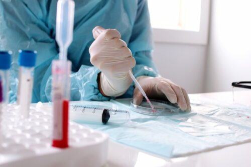 Scientist examining a patient's blood sample in a lab.