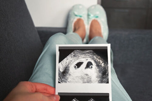 woman holding ultrasound of twins