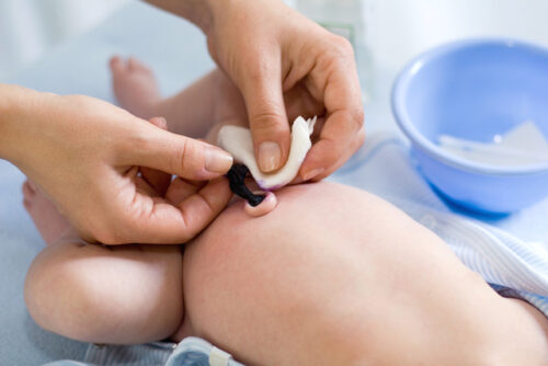 A person cleaning a newborn umbilical stump.