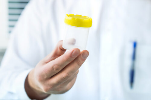 Doctor holding a jar containing a sperm donation.
