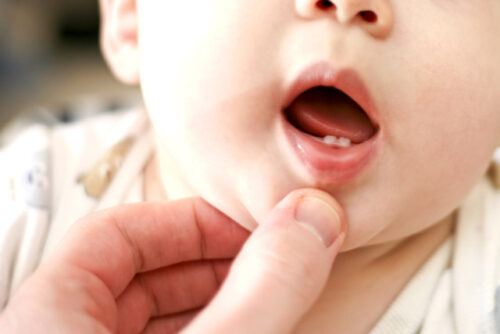 A person looking at their babies teeth wondering what age the rest of them come in.