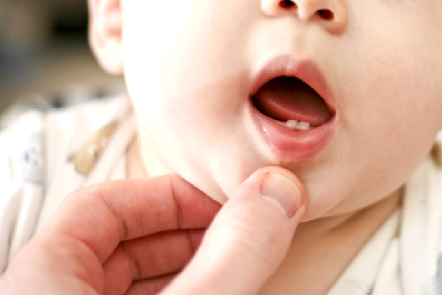 A person looking at their babies teeth wondering what age the rest of them come in.