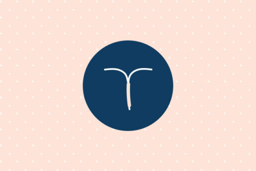 Design of IUD