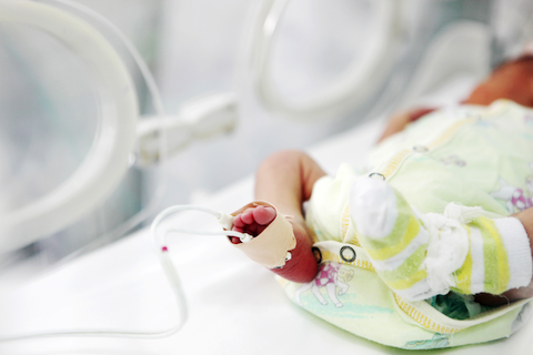 newborn baby lying in an incubator