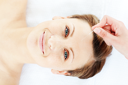 Smiling woman getting acupuncture