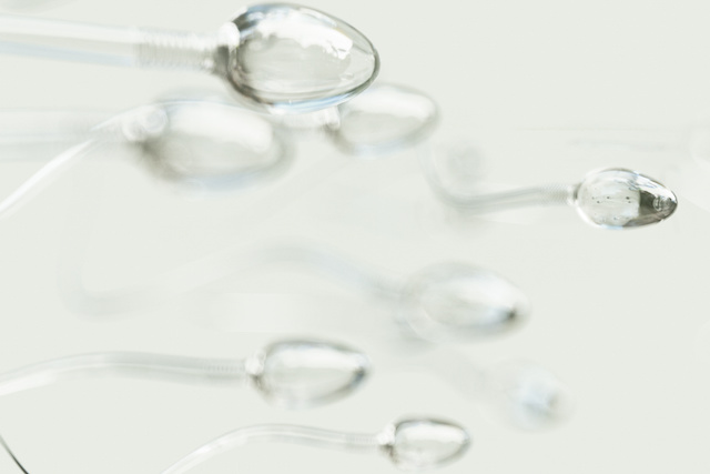 A close up representation of several sperm throughout their lifespan.